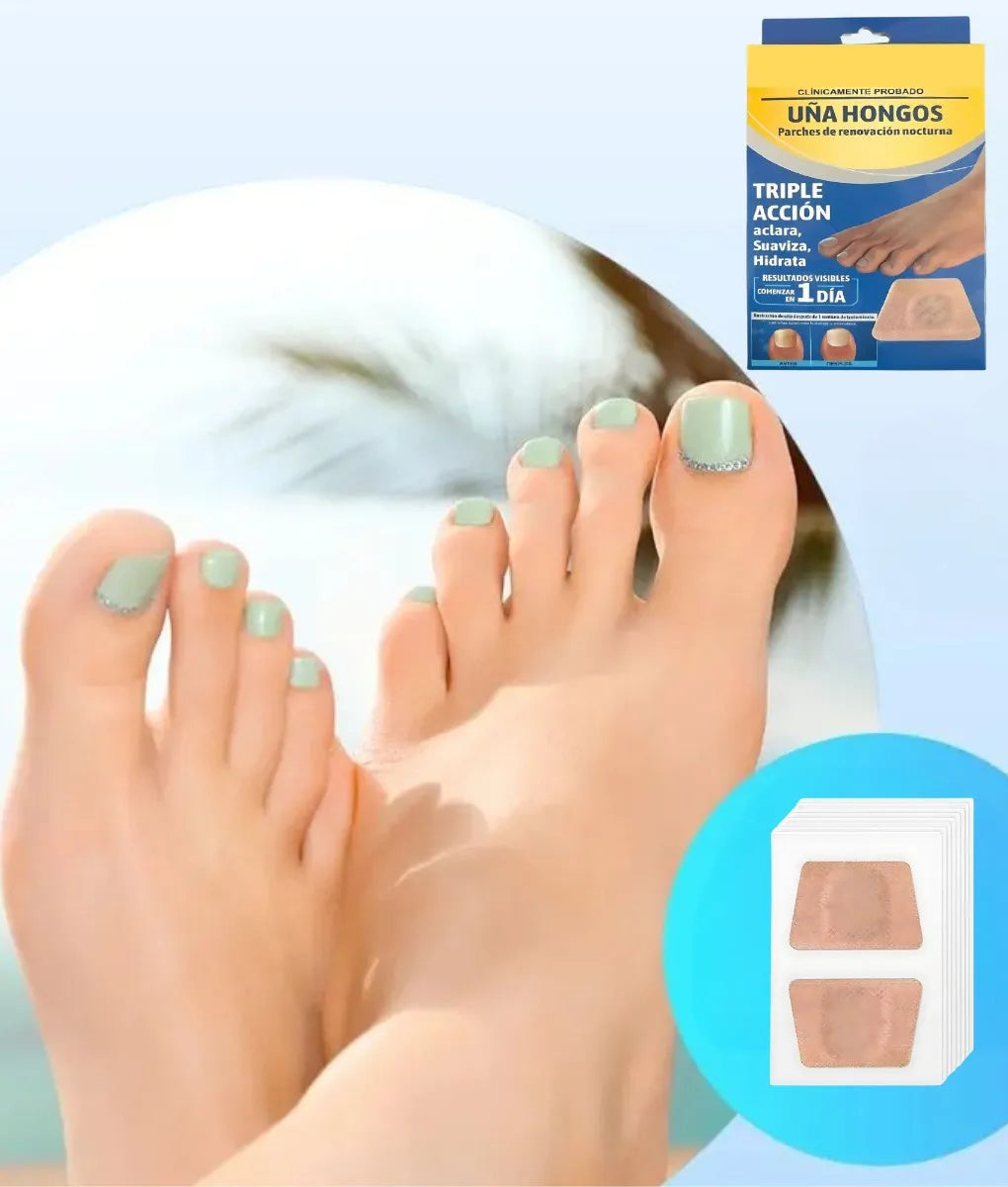 Parches antifúngicos – Solución práctica que elimina hongos y renueva tus uñas