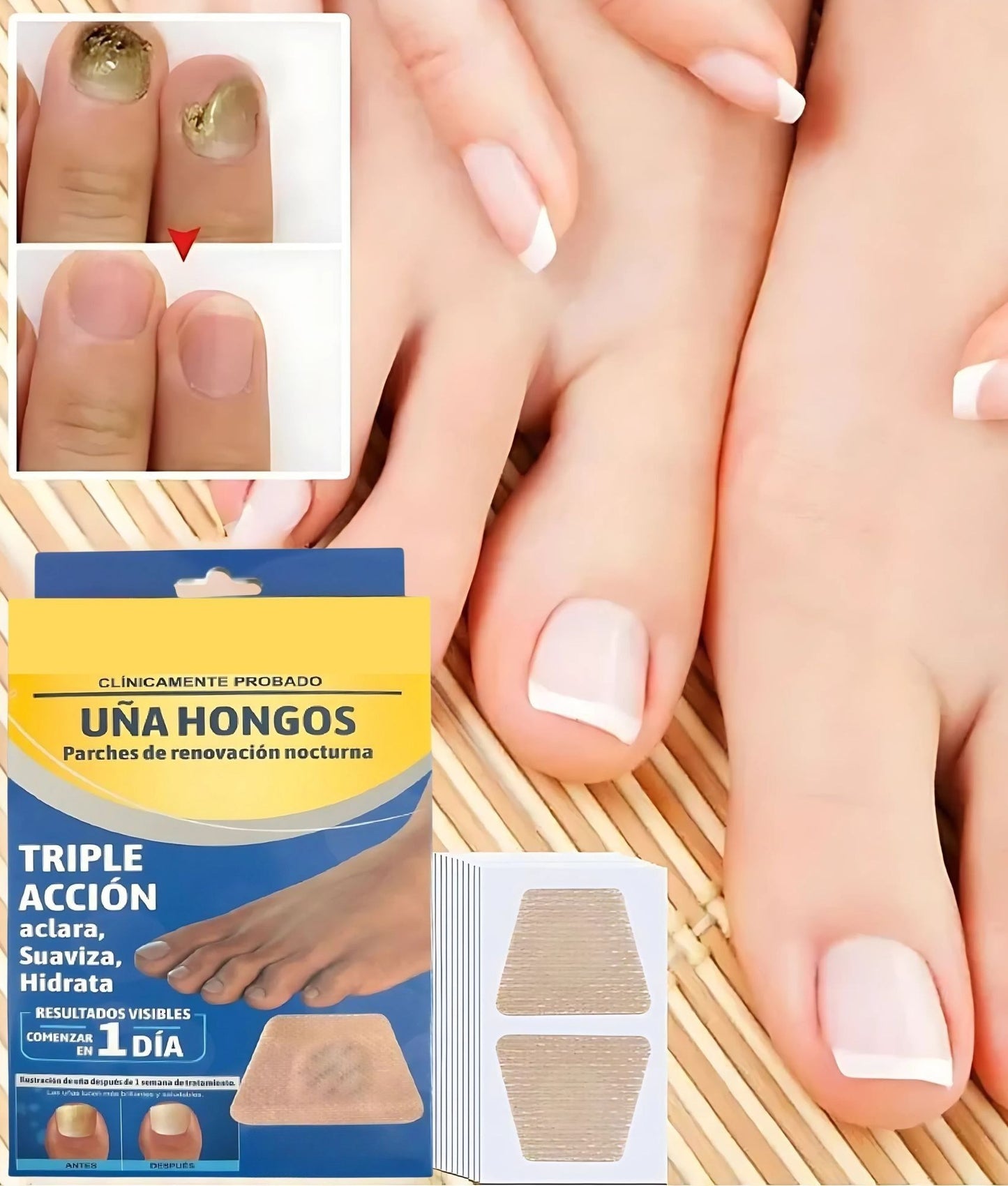 Parches antifúngicos – Solución práctica que elimina hongos y renueva tus uñas
